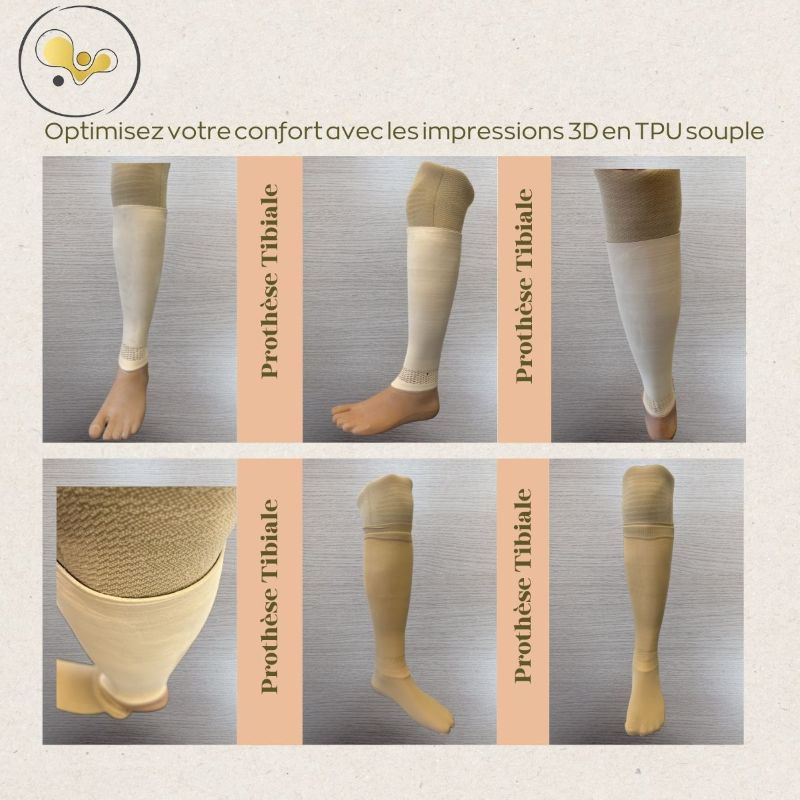 Esthétiques tibiales imprimées en TPU souple Perpignan