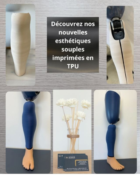 Esthétiques fémorale TPU Perpignan Esthétiques tibiales imprimées en TPU souple Perpignan